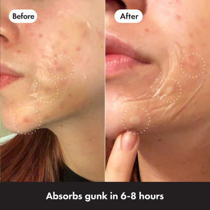 MIGHTY PATCH™ Surface