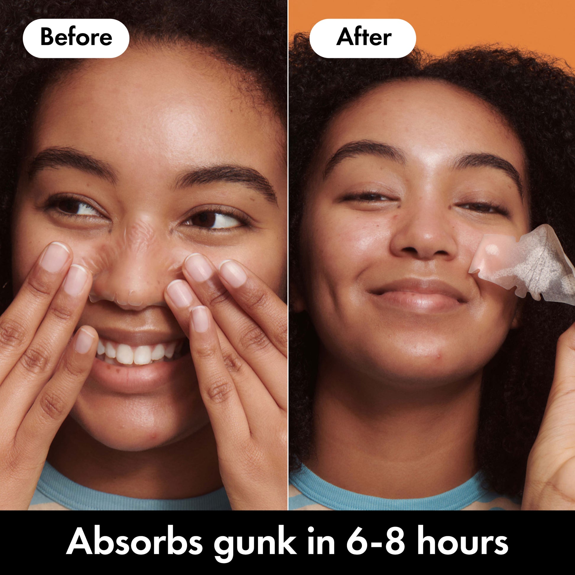 MIGHTY PATCH™ Nose