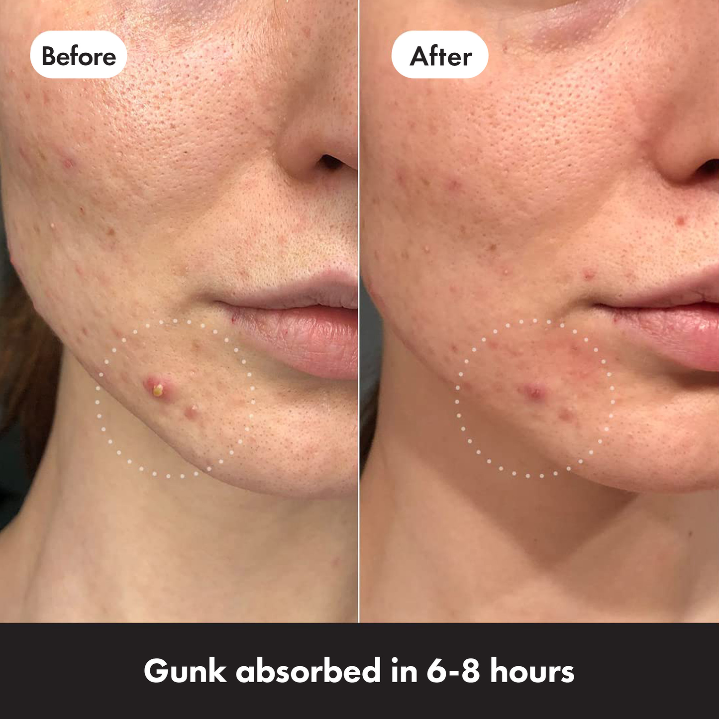 MIGHTY PATCH ™ Original 